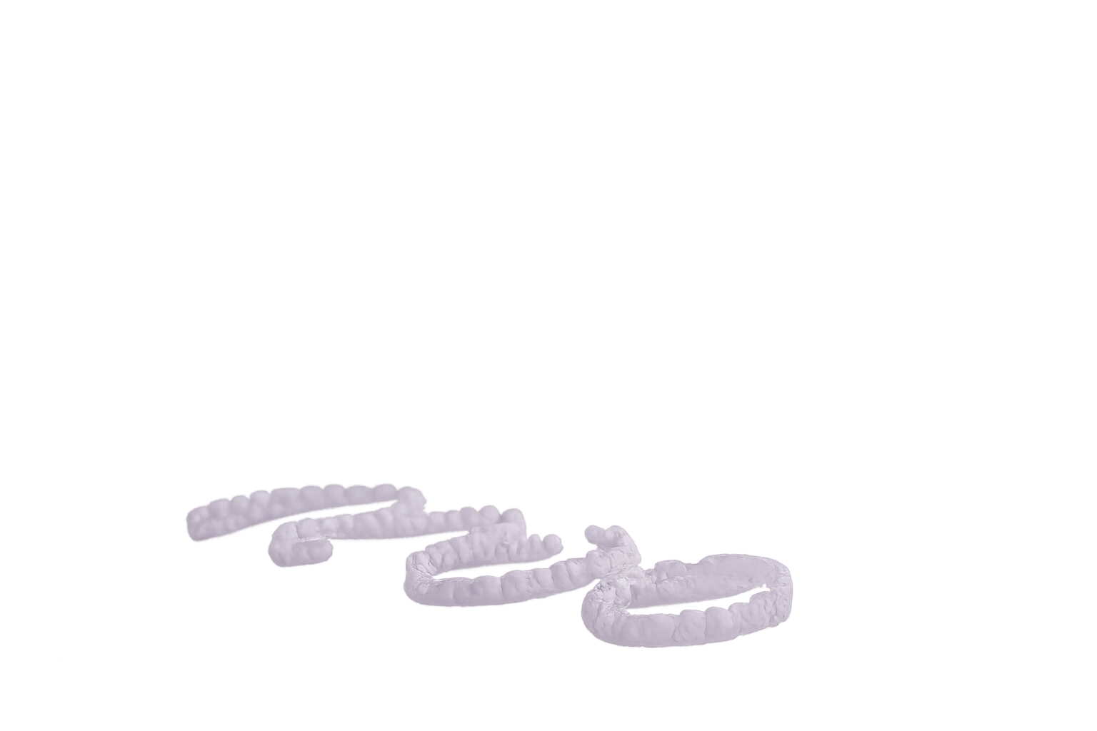 How Do Clear Aligners Work? Step-by-Step