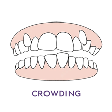 Crowding